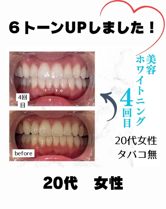 画像1015