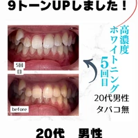 画像1033