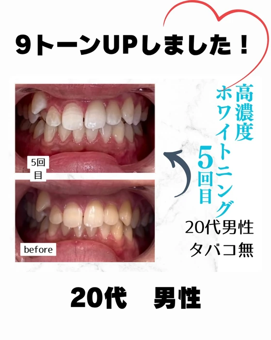 画像1033