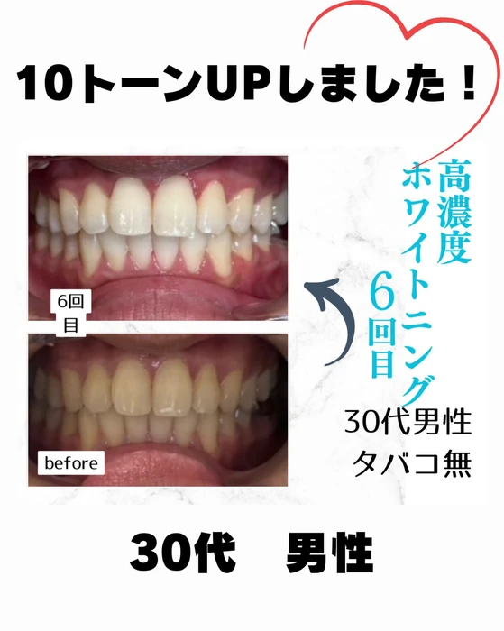 画像1041