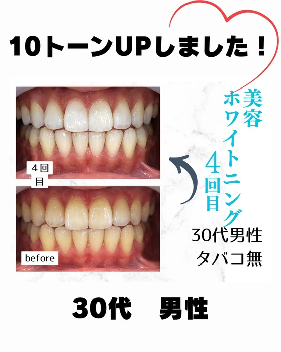 画像1055