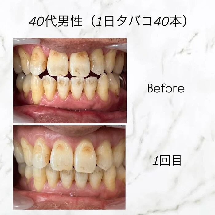 画像236