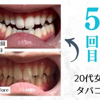 画像250