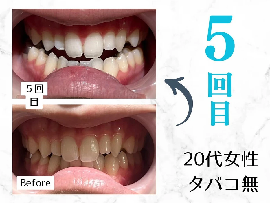 画像250