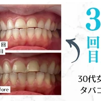 画像303