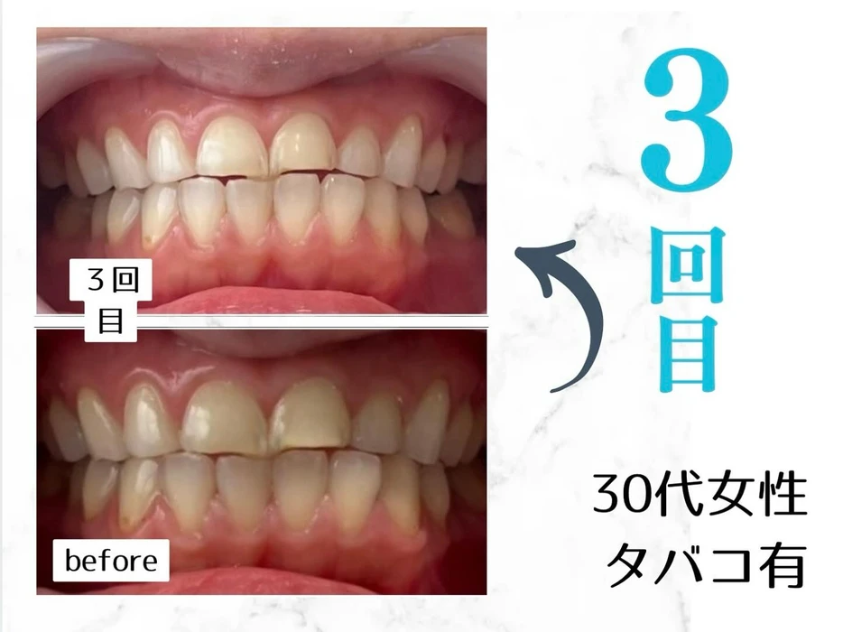 画像303