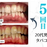 画像327