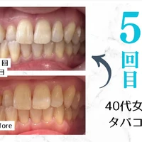 画像374