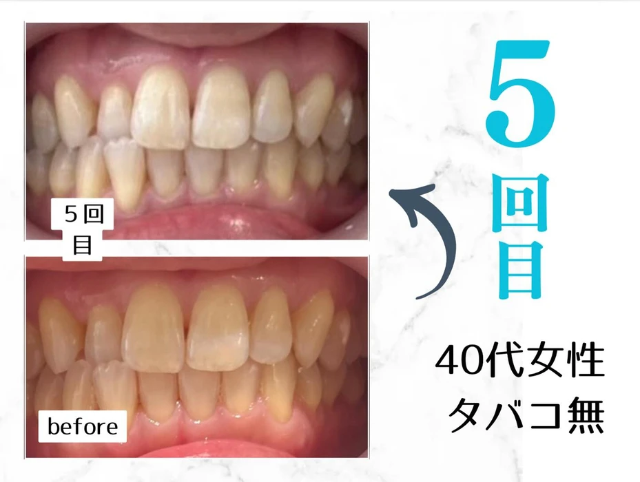 画像374