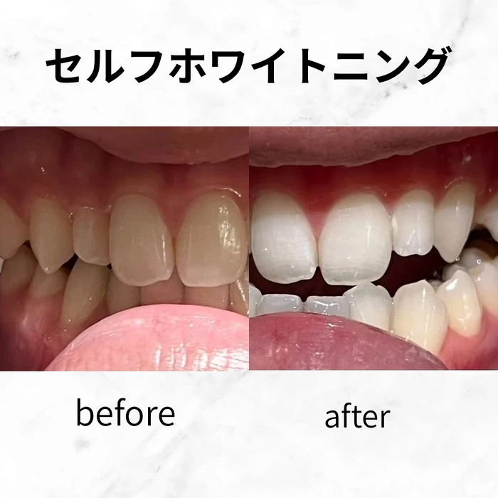 画像538