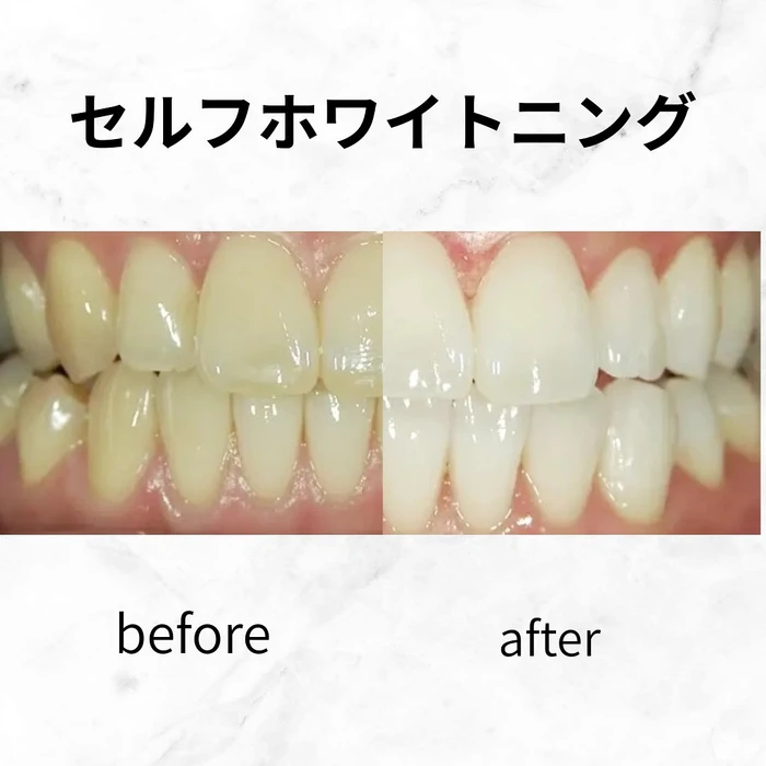 画像542
