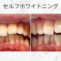 画像544