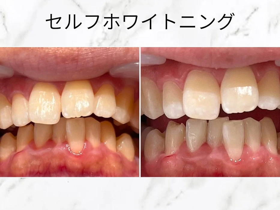 画像544