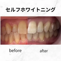 画像554