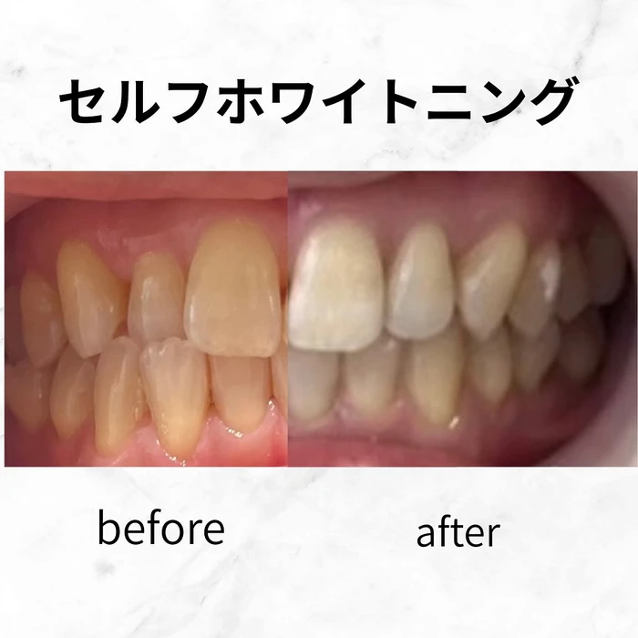画像554