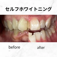 画像560