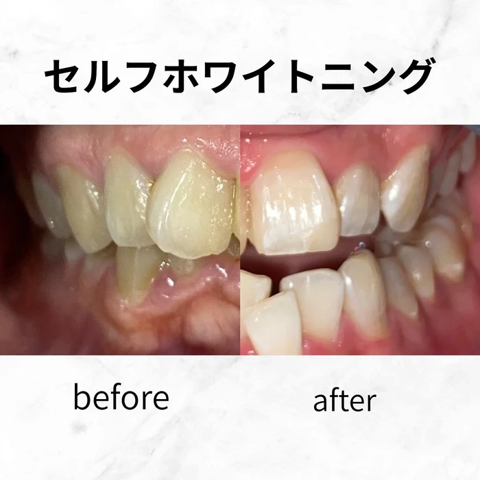 画像560