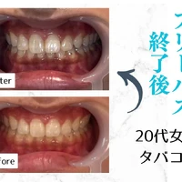 画像562