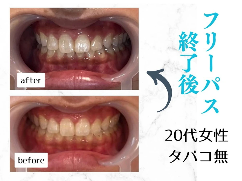 画像562