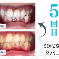 画像572
