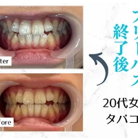 画像590