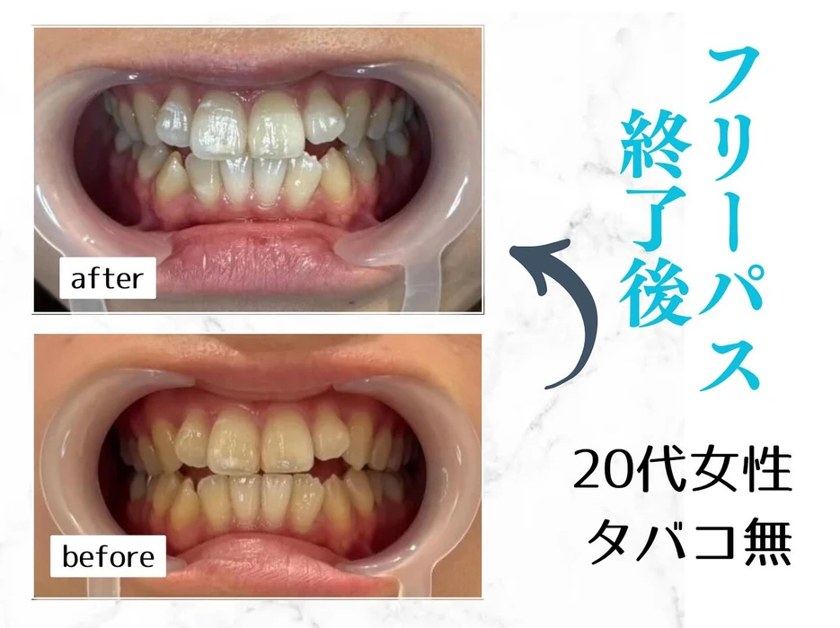 画像590