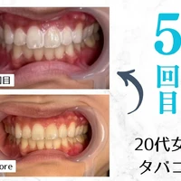画像598