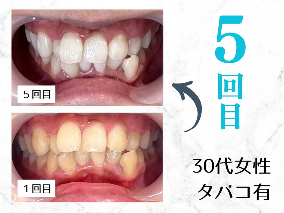 画像604