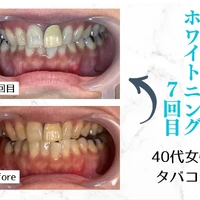 画像616