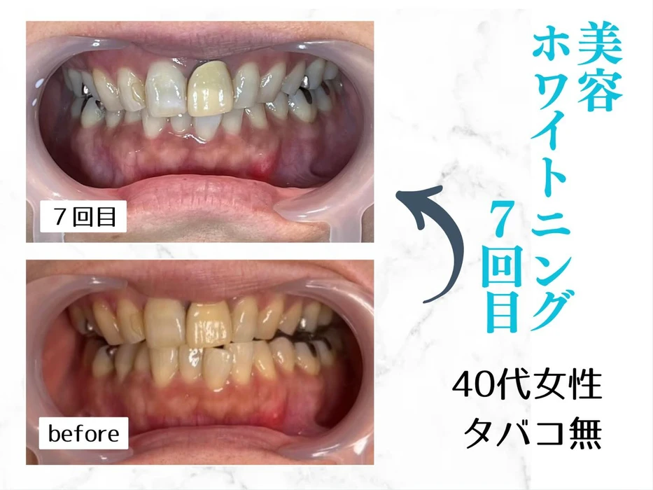 画像616