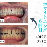 画像622