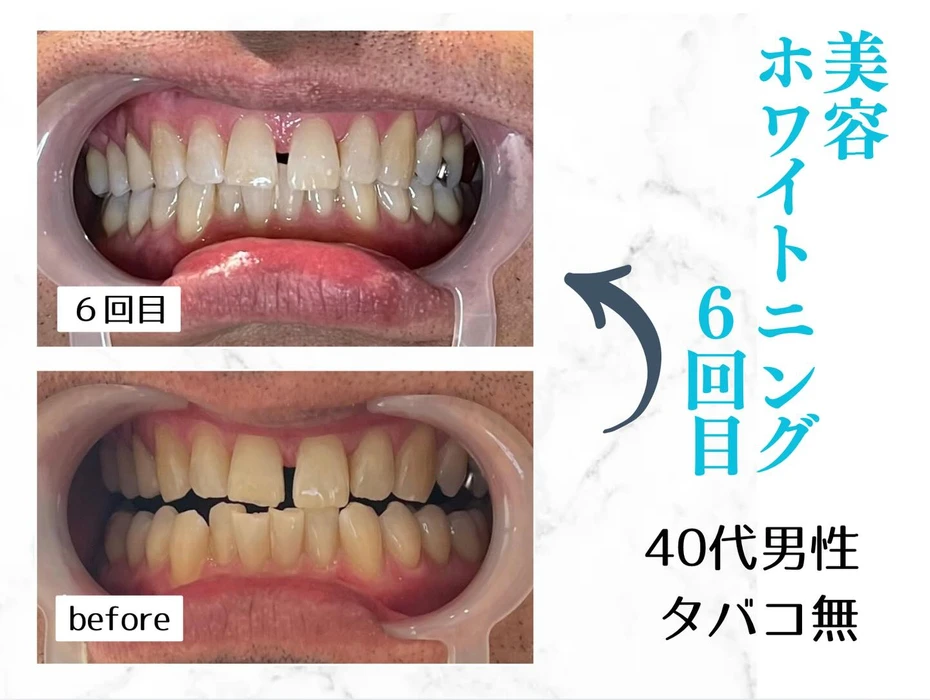 画像622