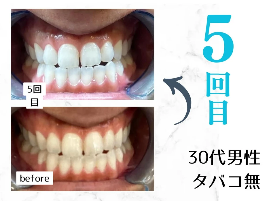 画像628