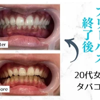 画像654