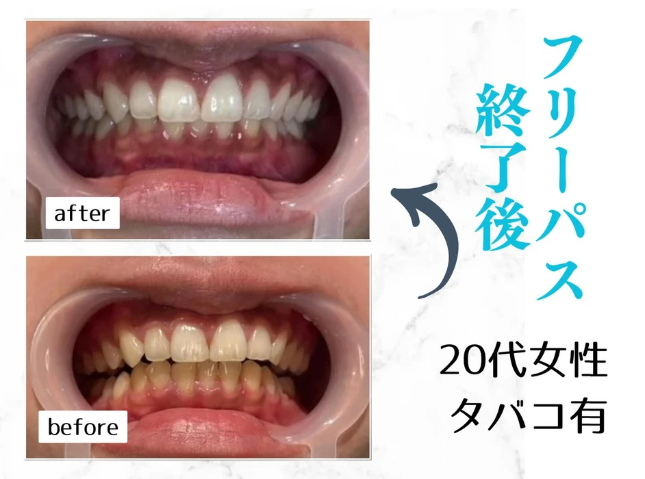 画像654