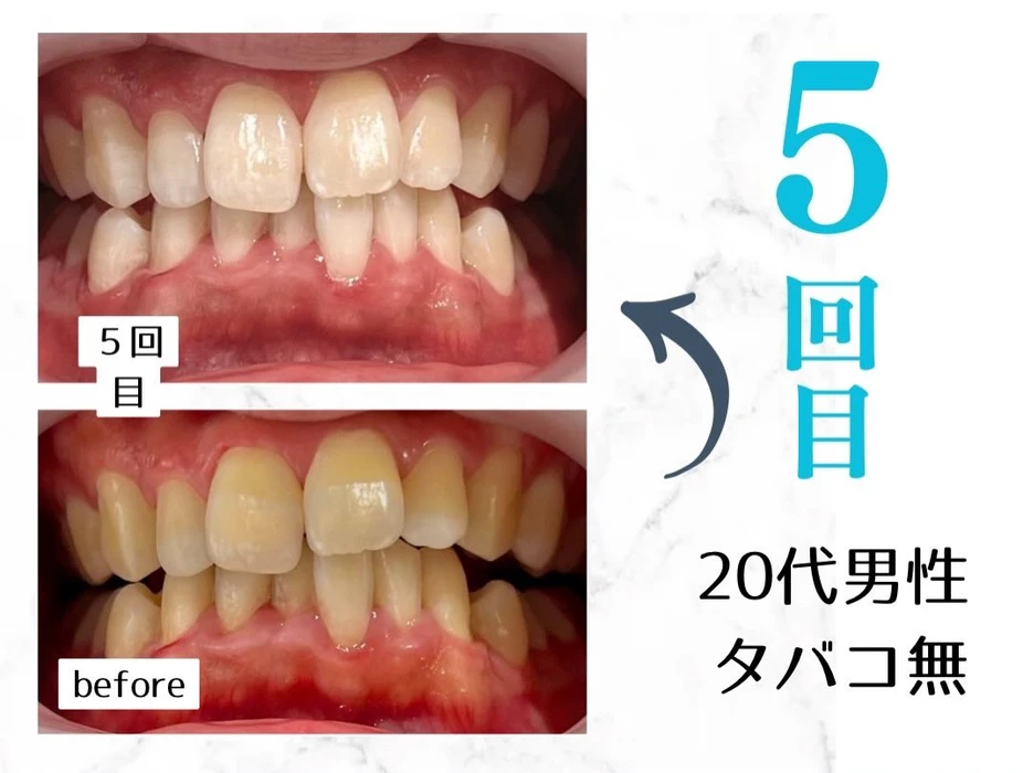 画像666