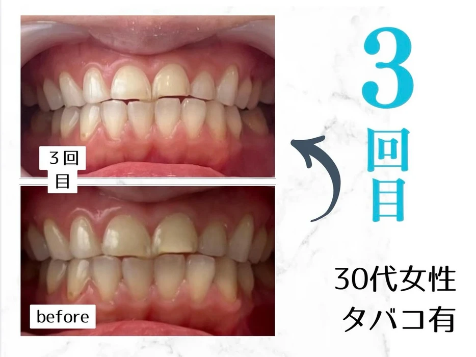 画像672