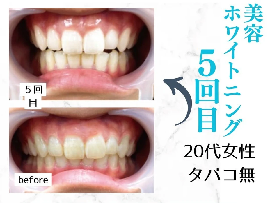 画像684