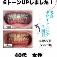 画像730