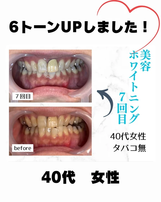 画像730