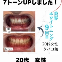 画像781