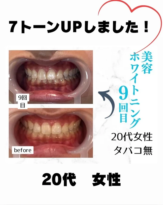 画像781