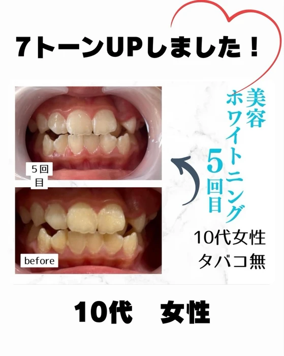 画像787