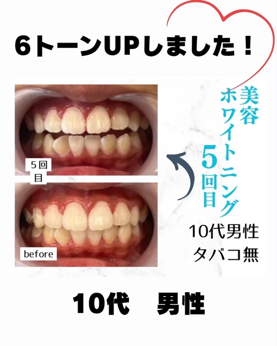 画像811