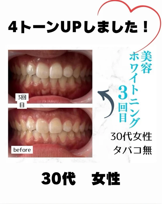 画像827