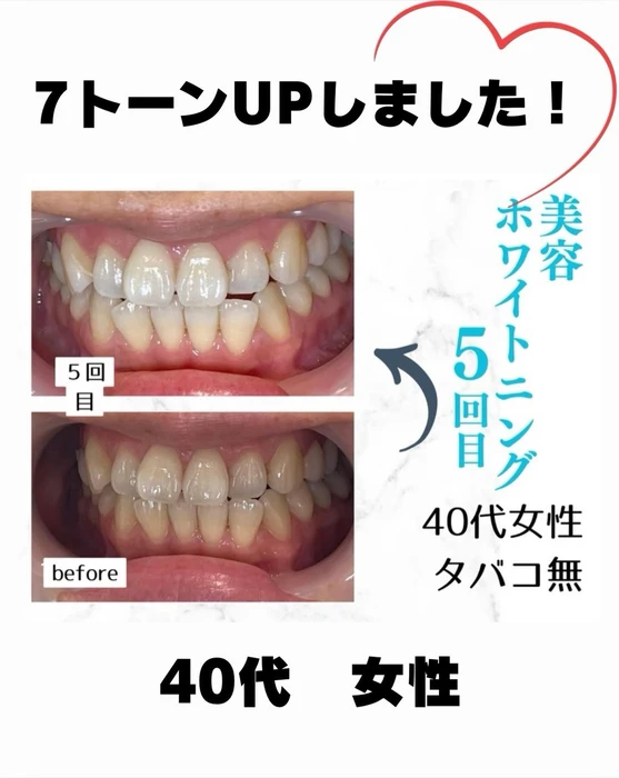 画像833