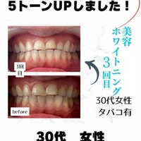画像851