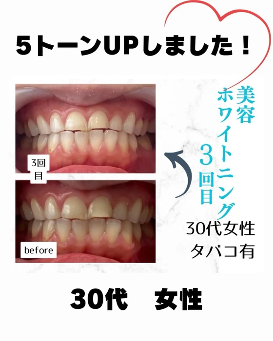 画像851