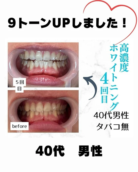 画像863