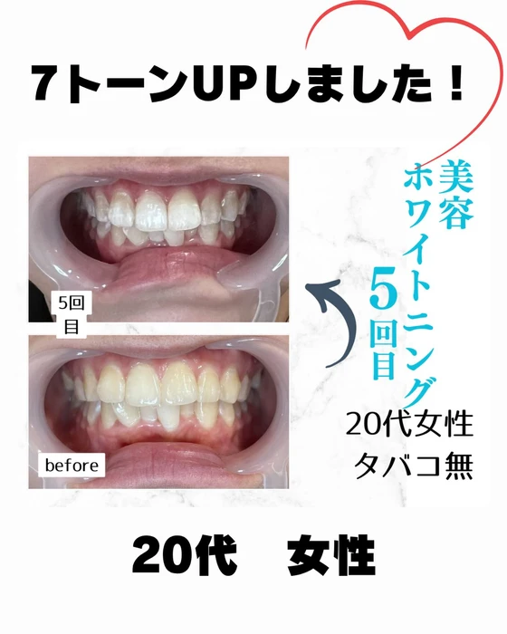 画像909